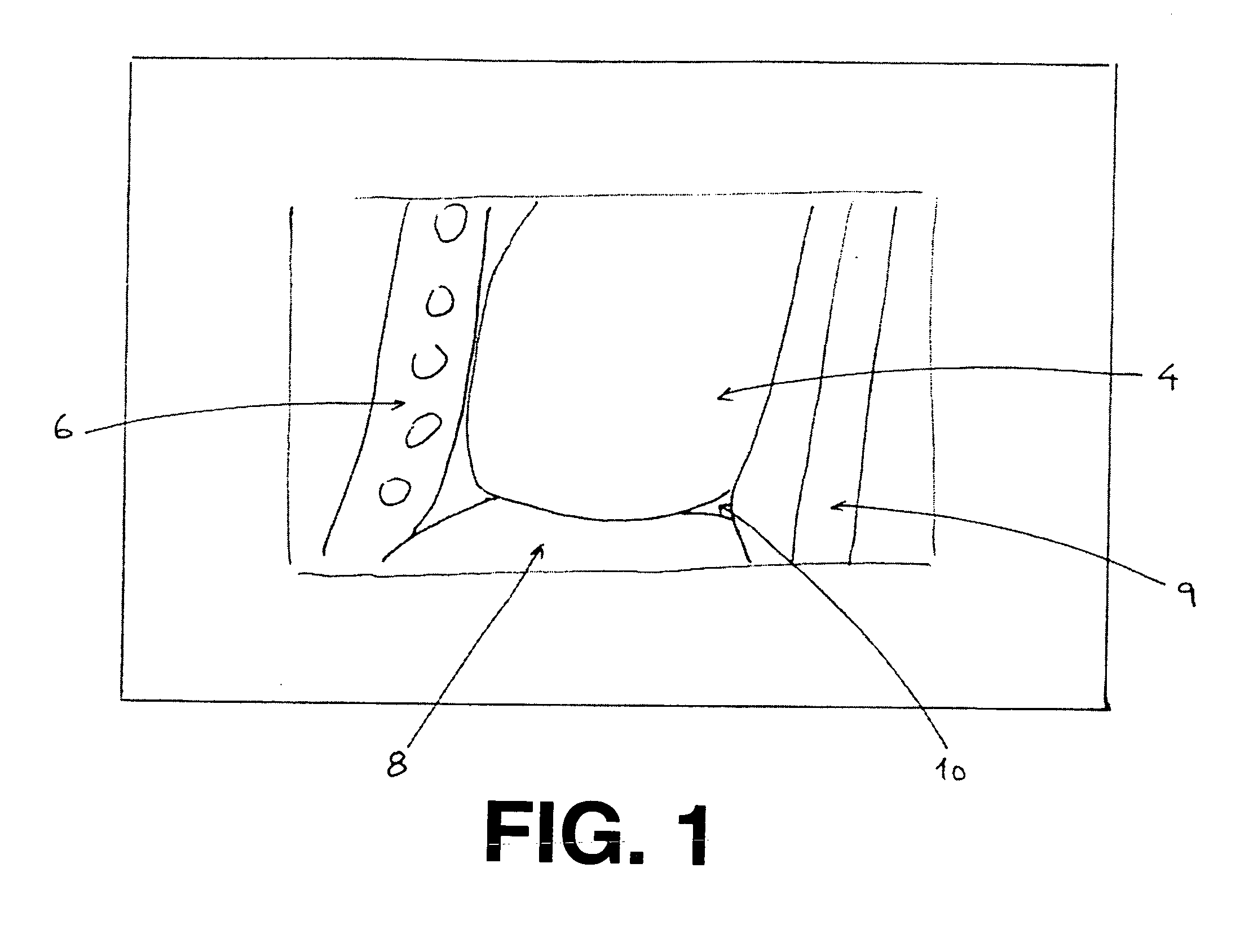 Method and system for processing an image of body tissues