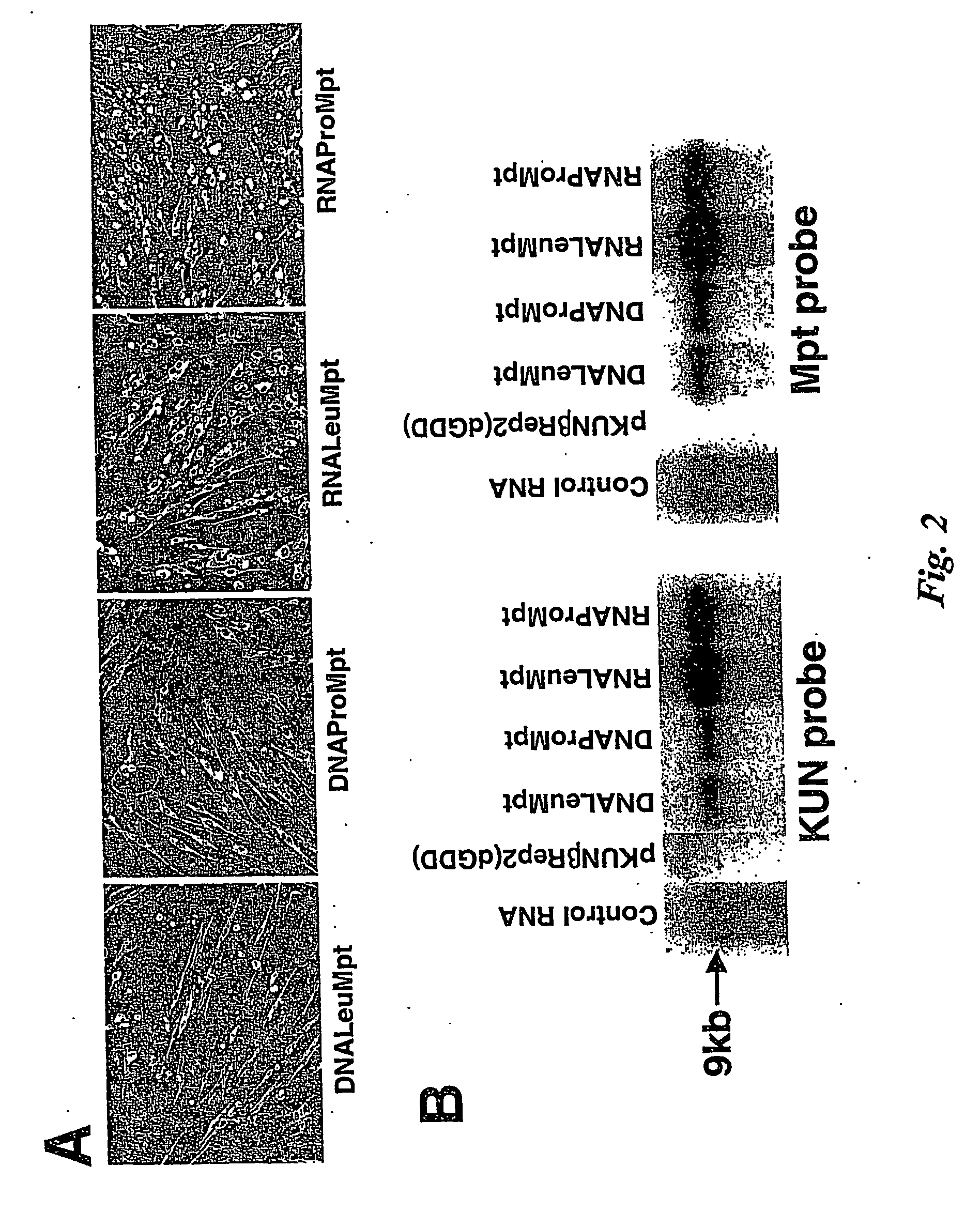 Flavivirus vaccine delivery system