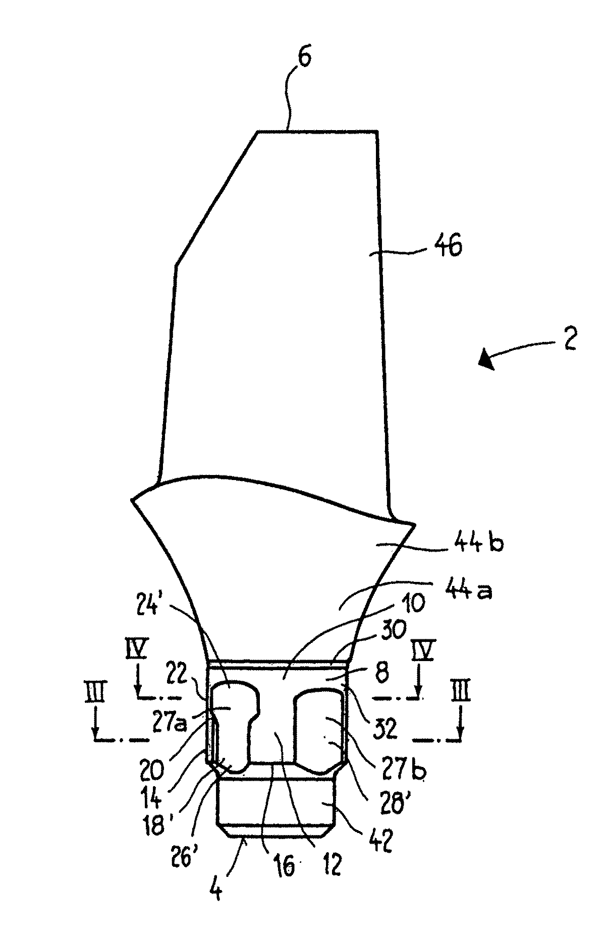 Abutment for a dental implant