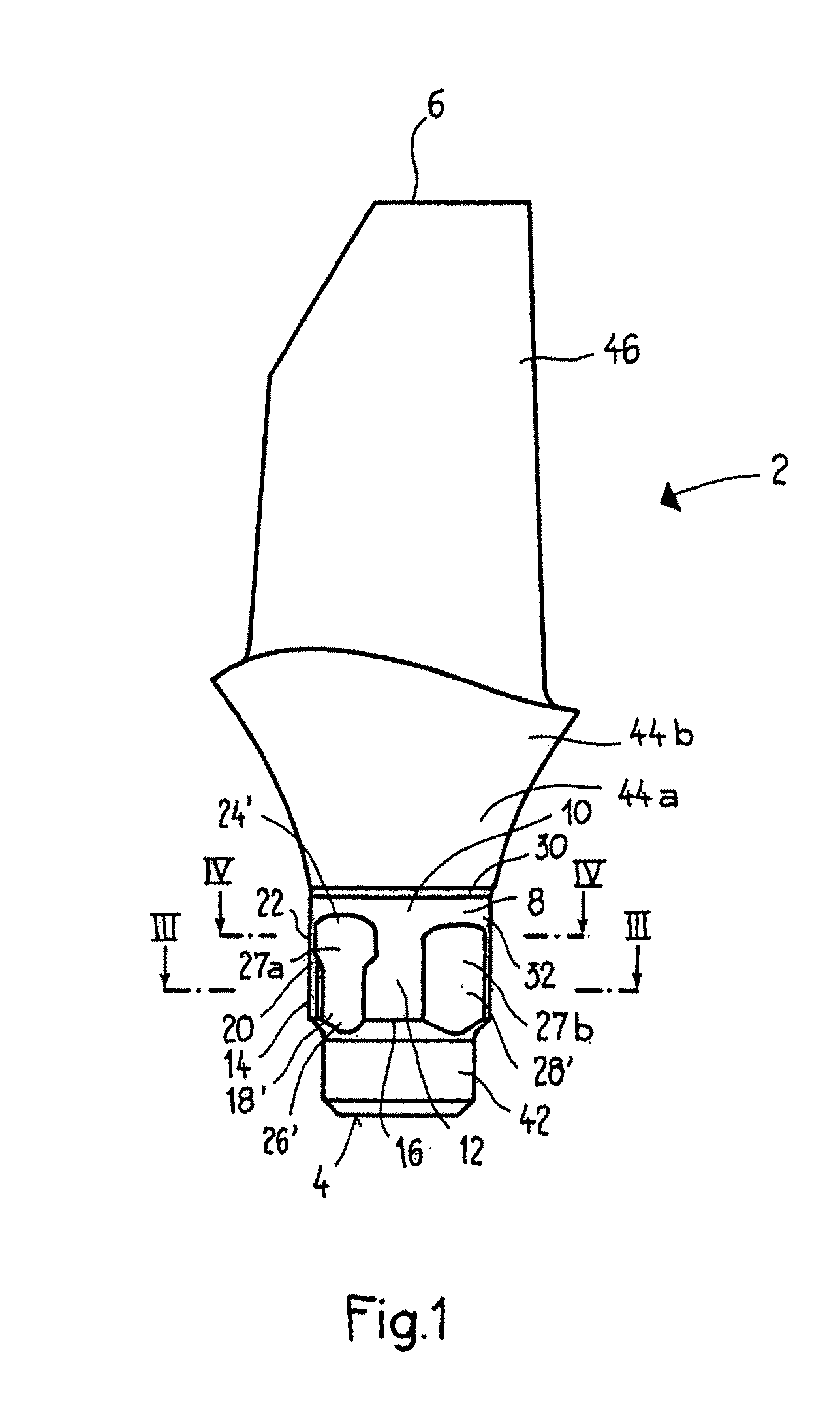 Abutment for a dental implant