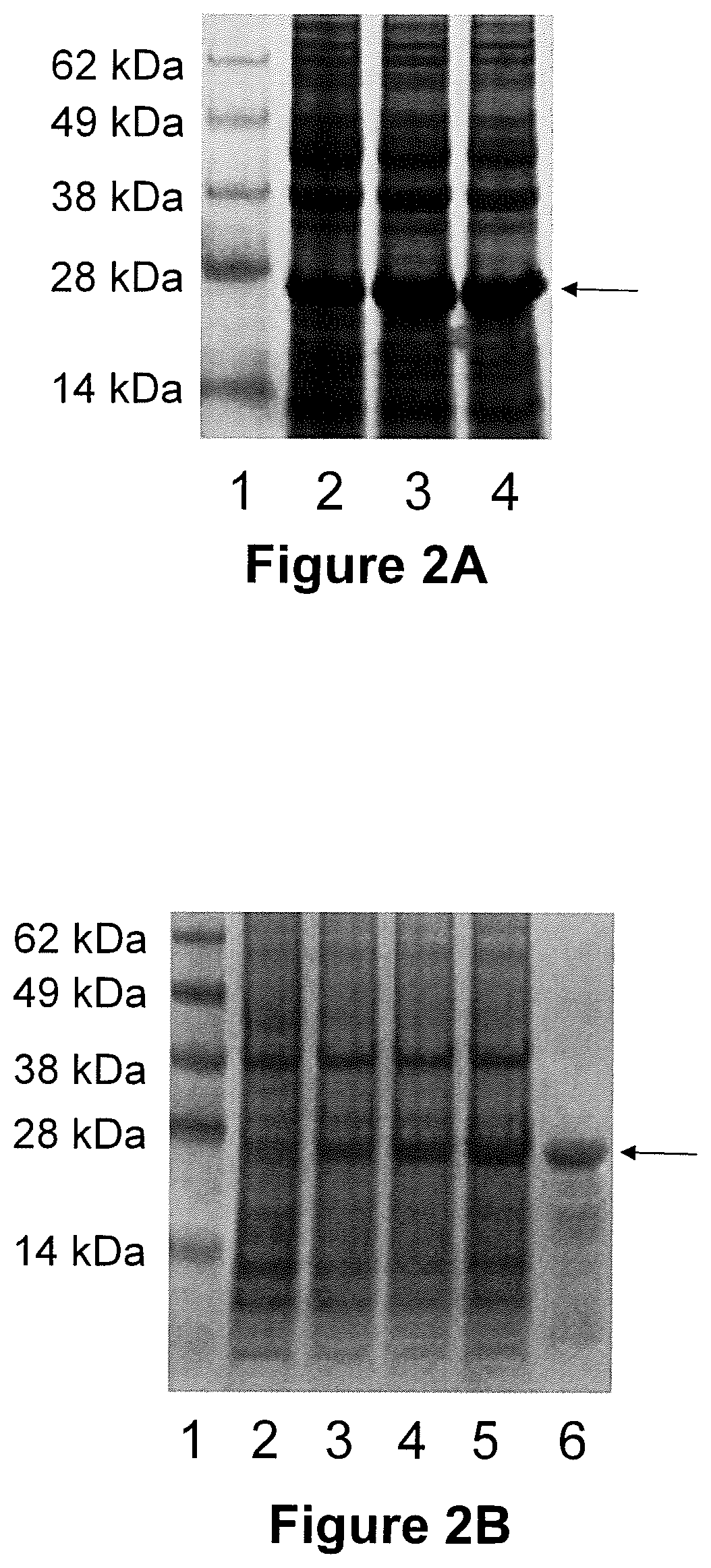 Chimeric vaccine antigens for anaplasmosis