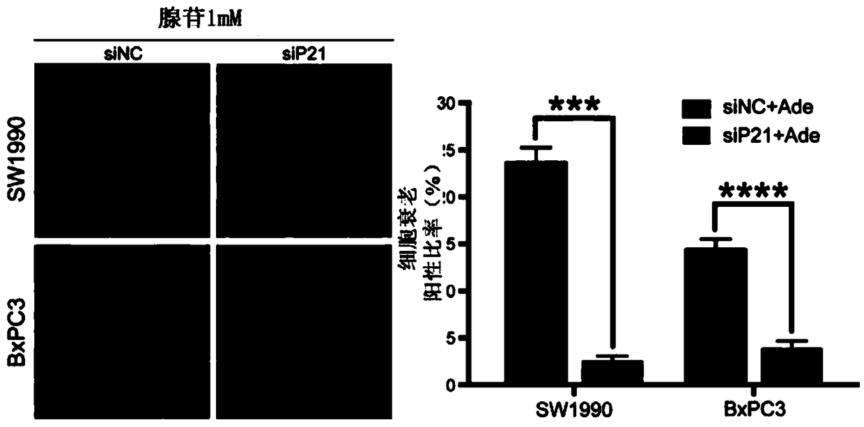 Pharmaceutical composition with synergistic effect for treating pancreatic cancer