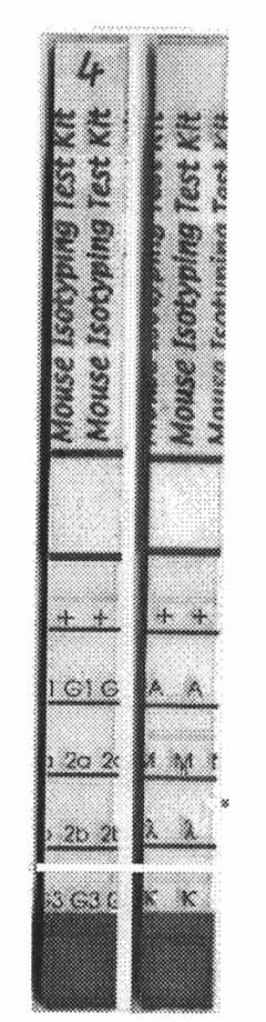 Monoclonal antibody TBEF3 of tubercle bacillus-resistant ESAT-6 and application thereof