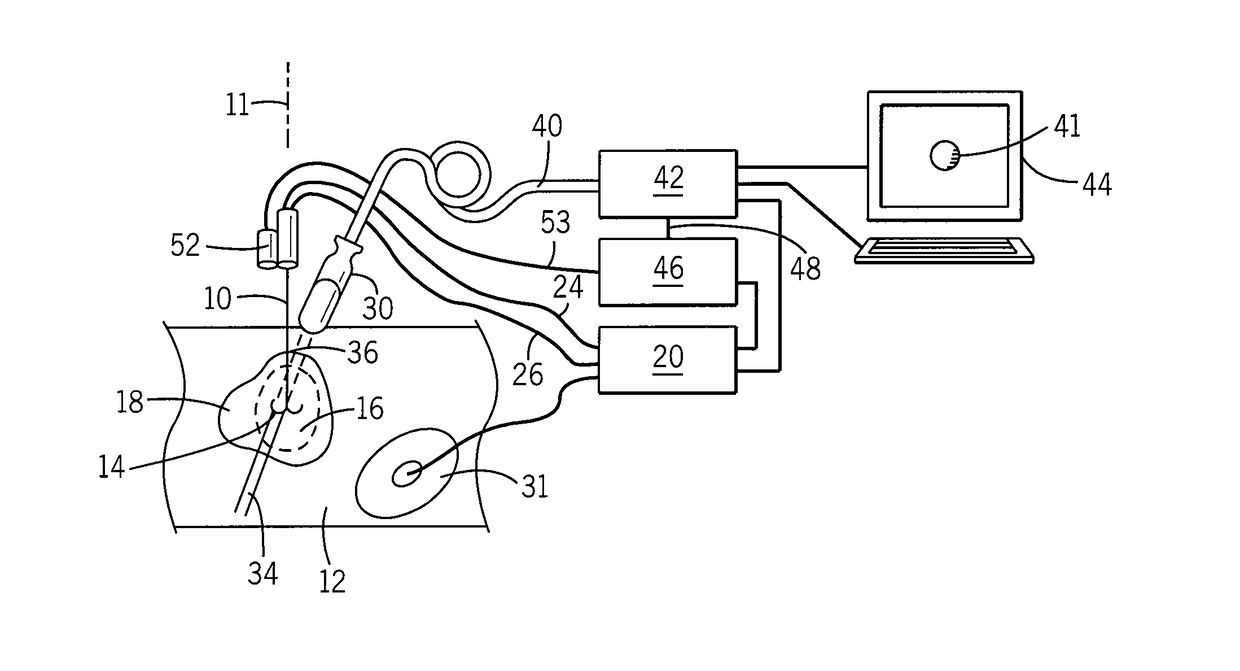 Method and apparatus for rapid acquisition of elasticity data in three dimensions