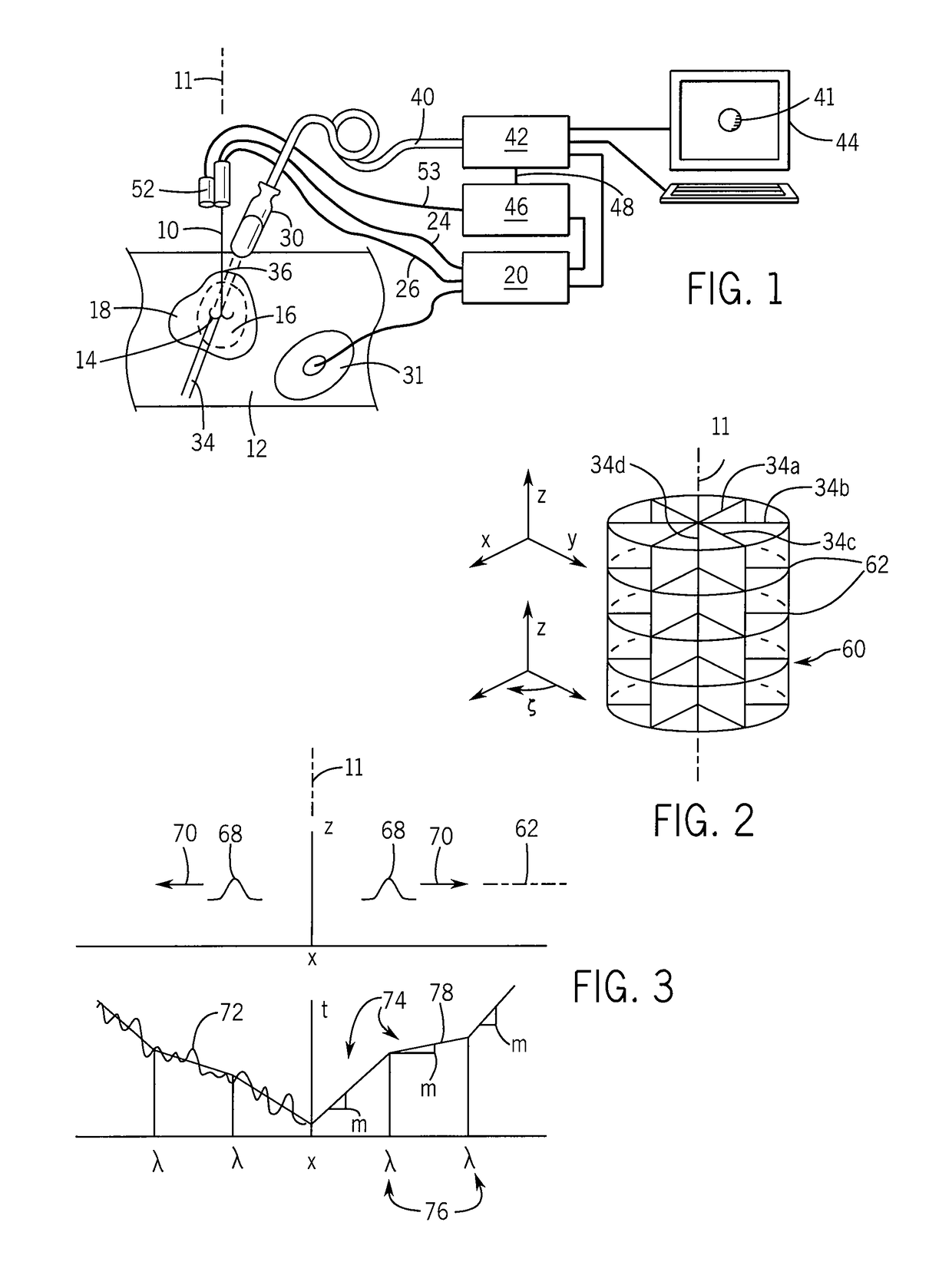 Method and apparatus for rapid acquisition of elasticity data in three dimensions