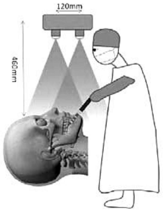 A method for generating patient body surface projection image sequences