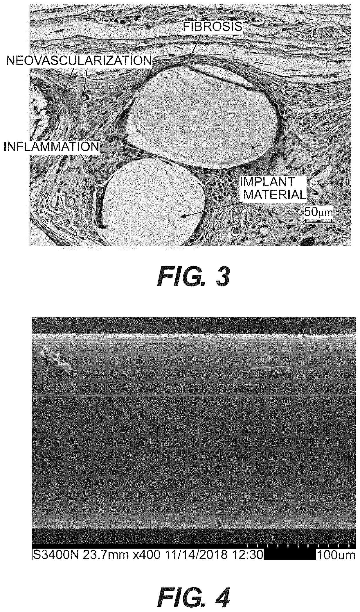 Medical devices containing poly(butylene succinate) and copolymers thereof