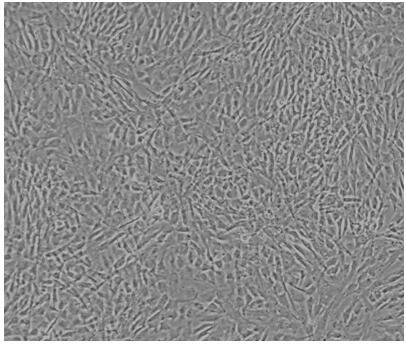 Method for culturing endometrial cells