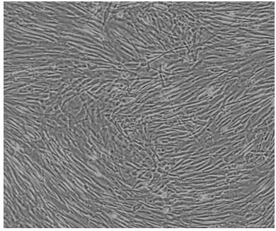 Method for culturing endometrial cells