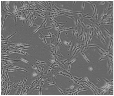 Method for culturing endometrial cells