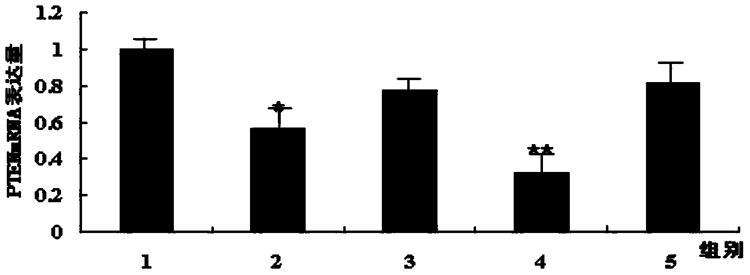 PTEN (phosphatase and tensin homolog) gene interference shRNA3, and recombinant adenovirus vector and construction thereof