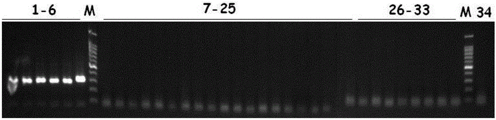 Pseudomonas aeruginosa detection kit and application thereof