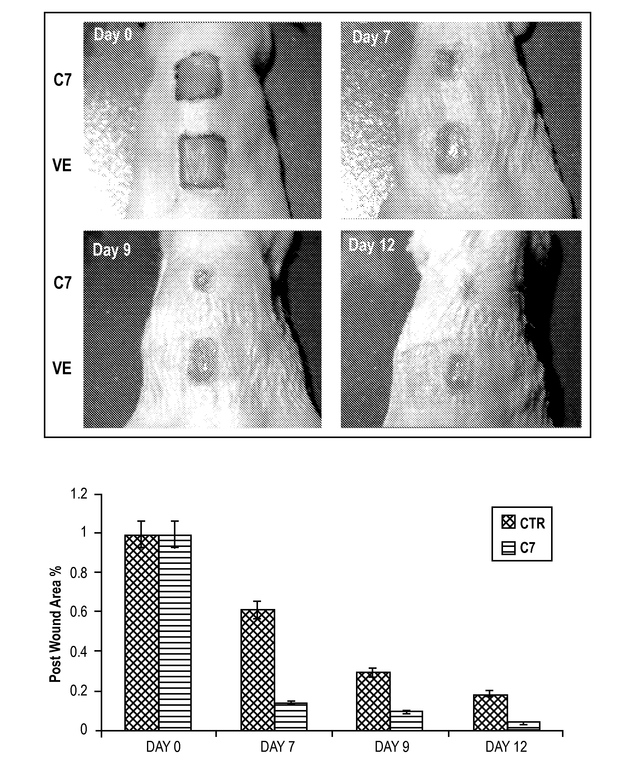 Composition and Method for Healing of Skin Wounds