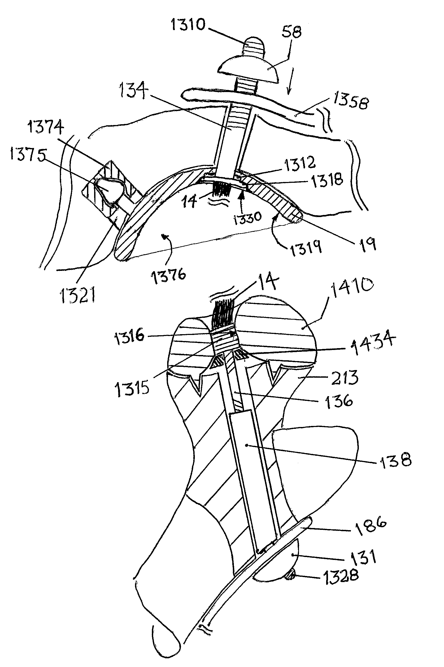 Socket and prosthesis for joint replacement