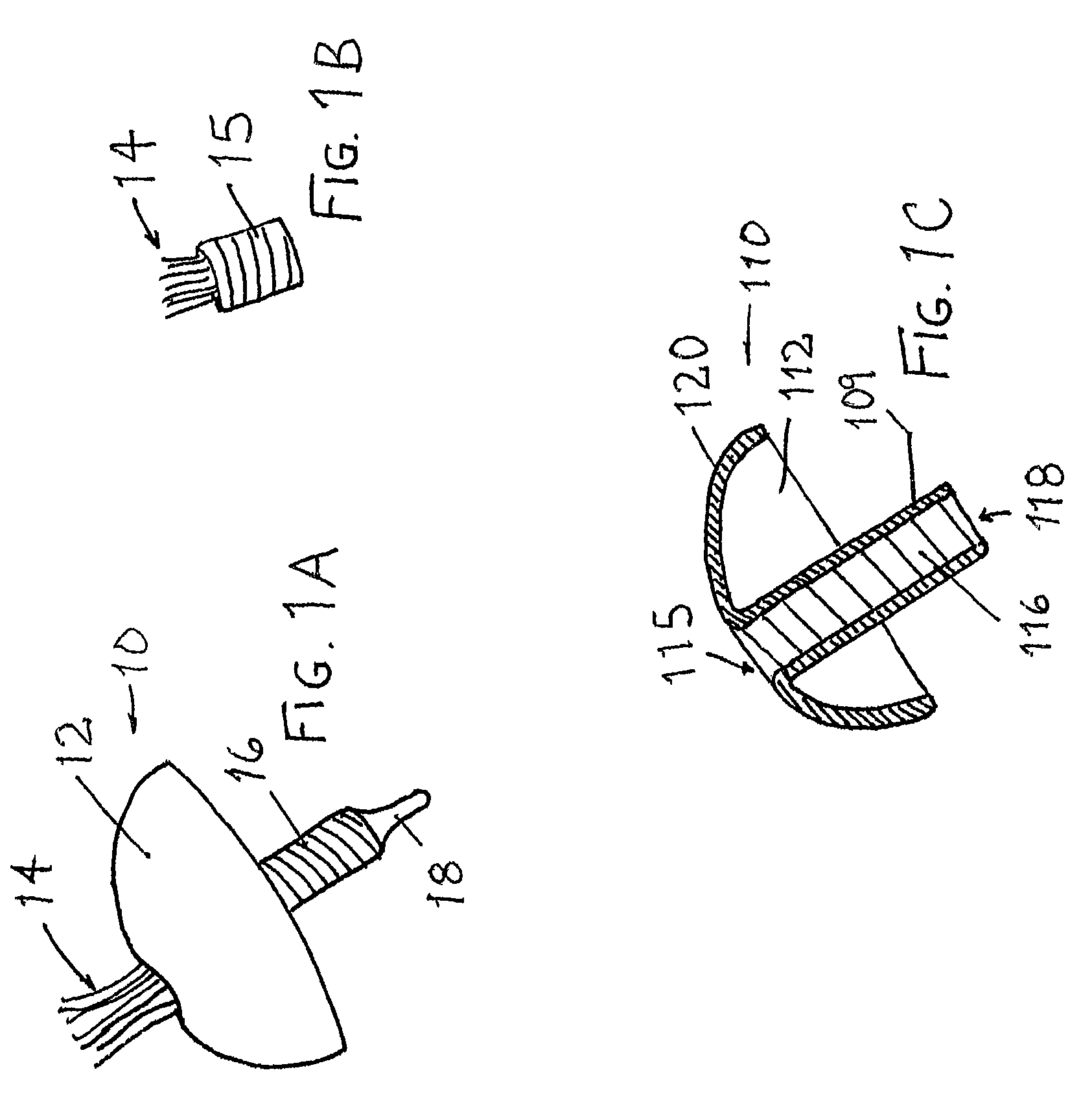 Socket and prosthesis for joint replacement