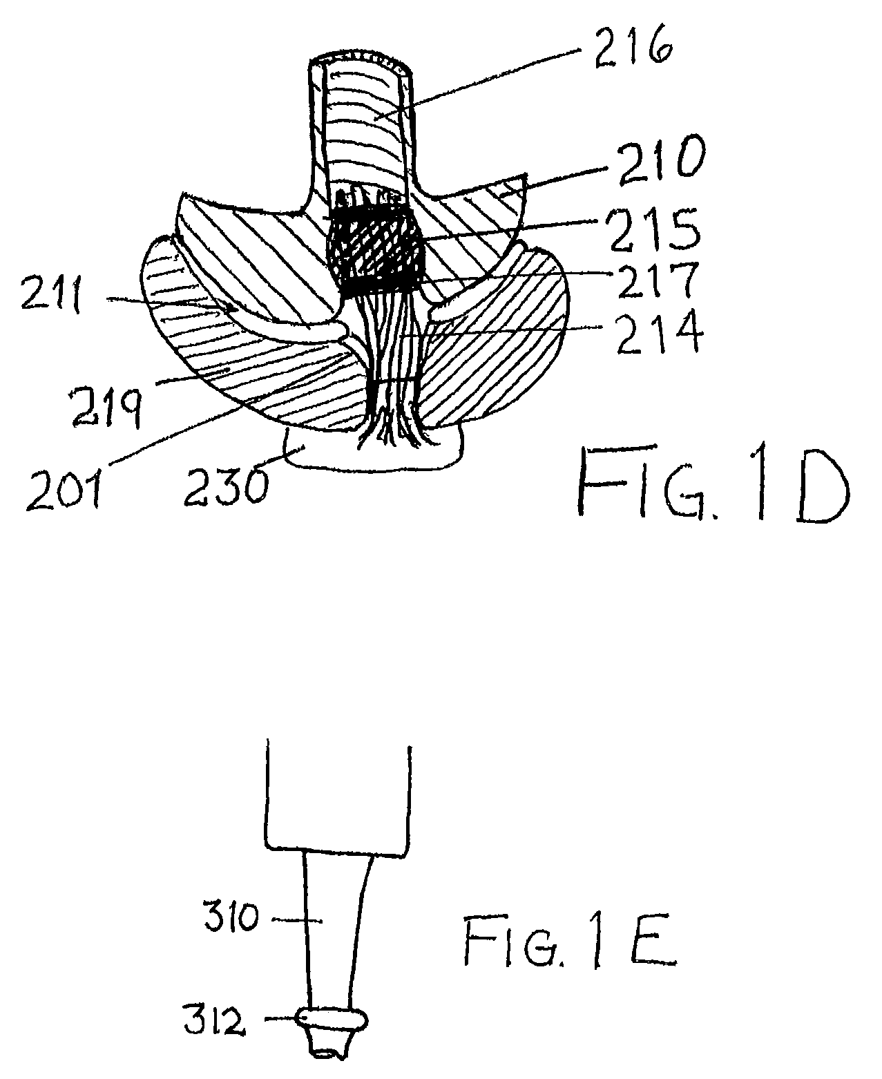 Socket and prosthesis for joint replacement