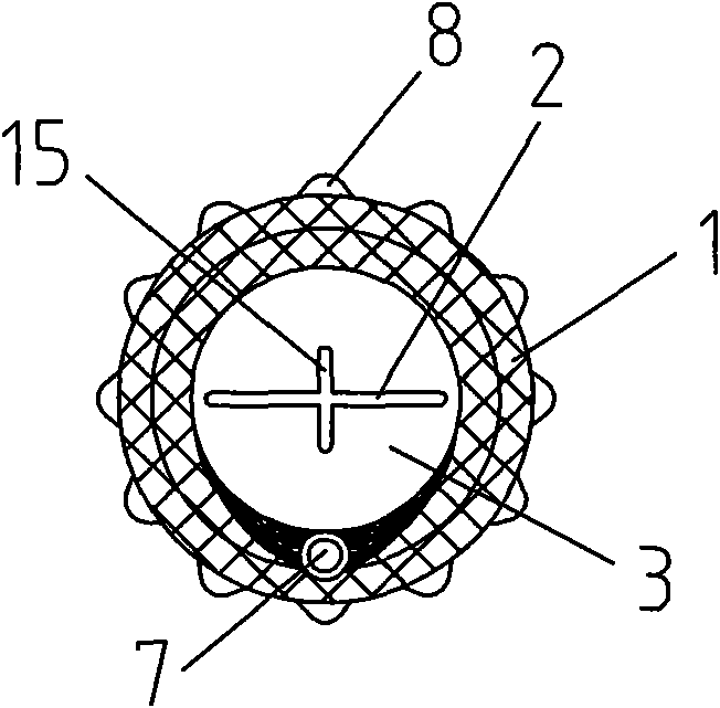 Recyclable unidirectional valve covered stent