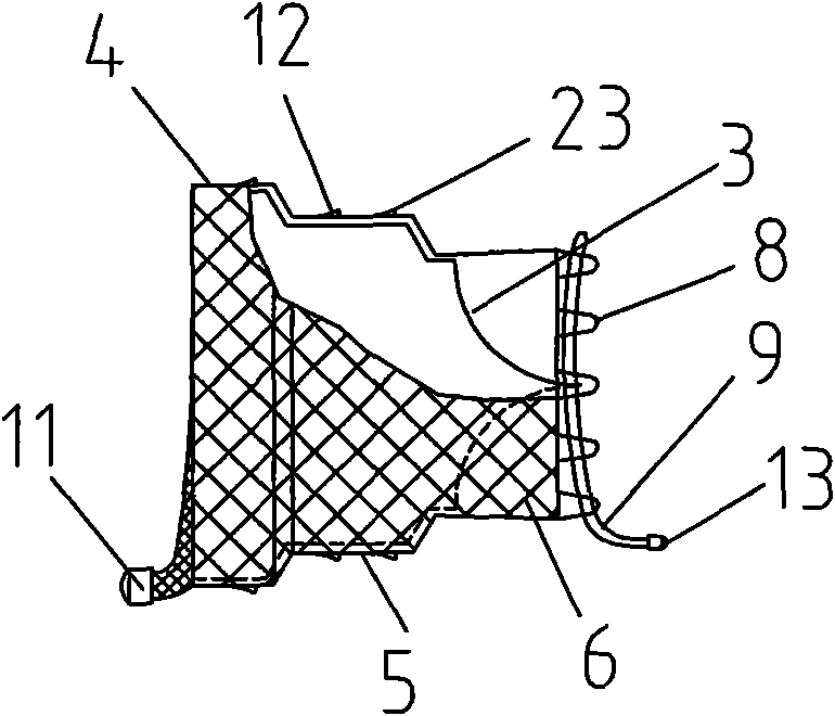 Recyclable unidirectional valve covered stent