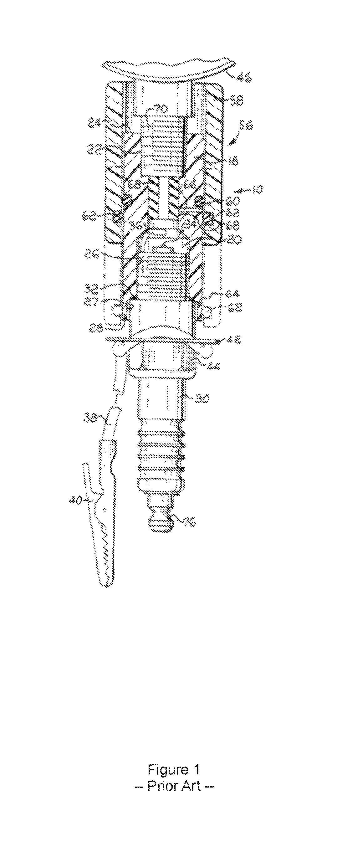 Spark plug testing kit