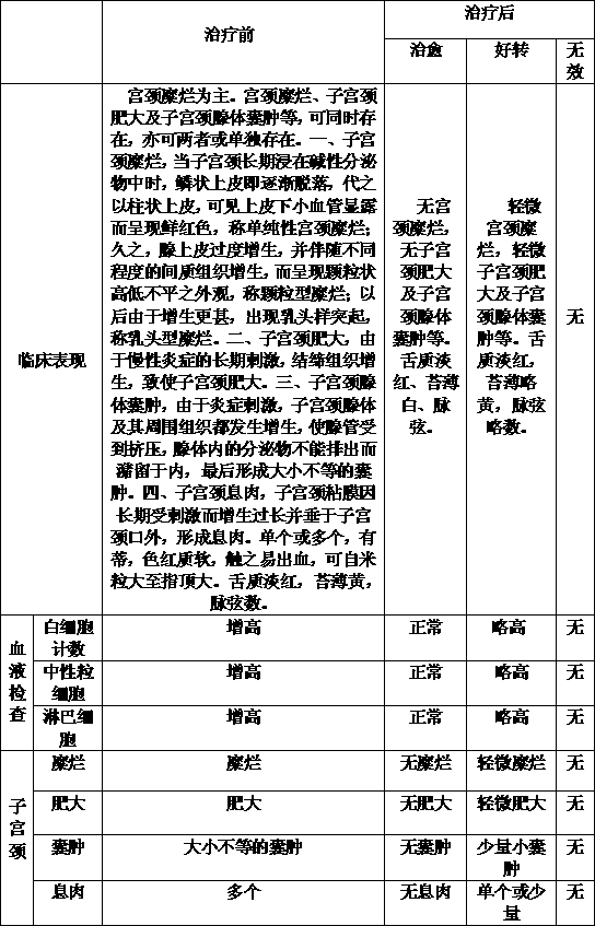 Preparation method of Chinese medicine irrigation solution for treating erosive type chronic cervicitis