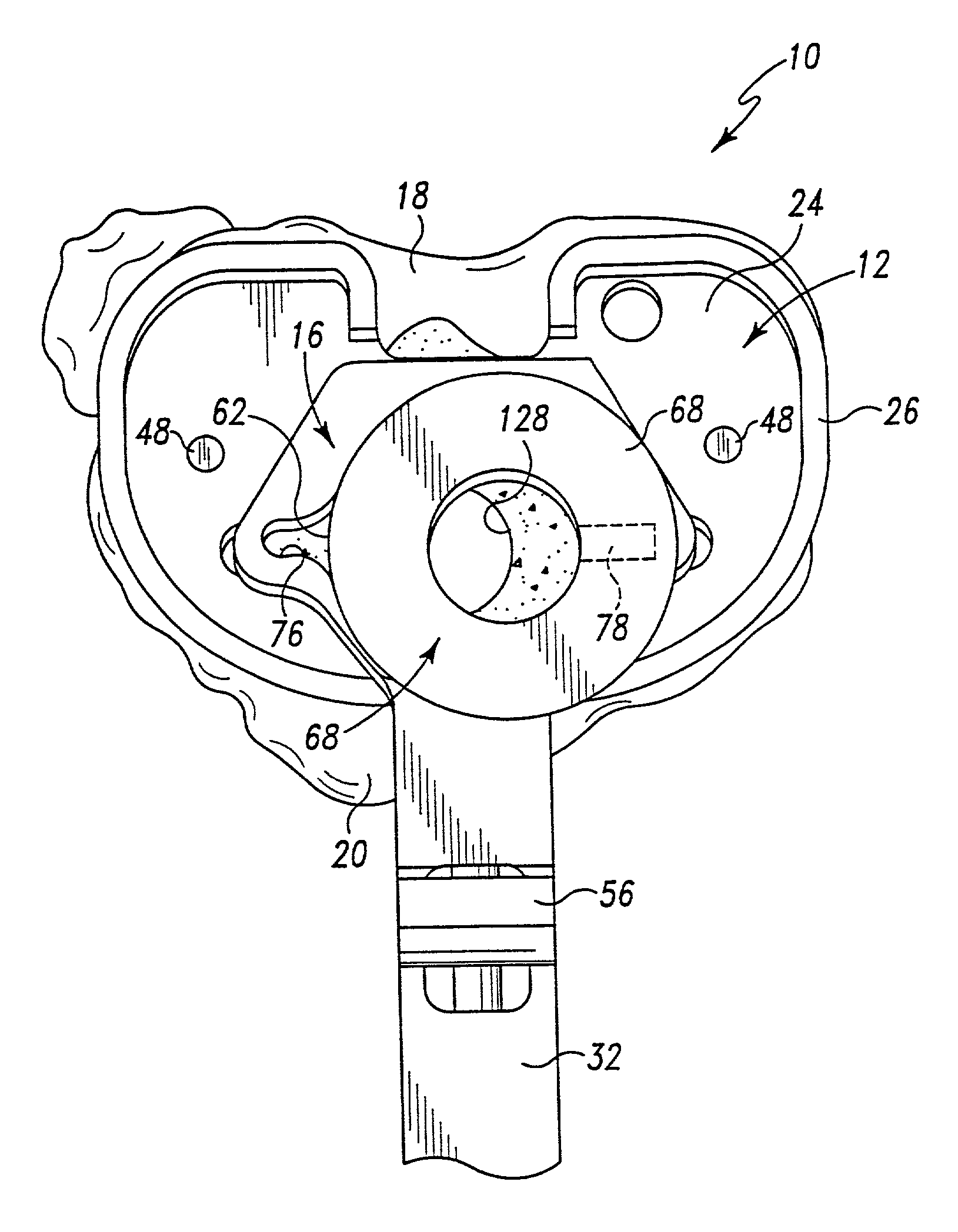 Method and apparatus for surgically preparing a tibia for implantation of a prosthetic implant component which has an offset stem