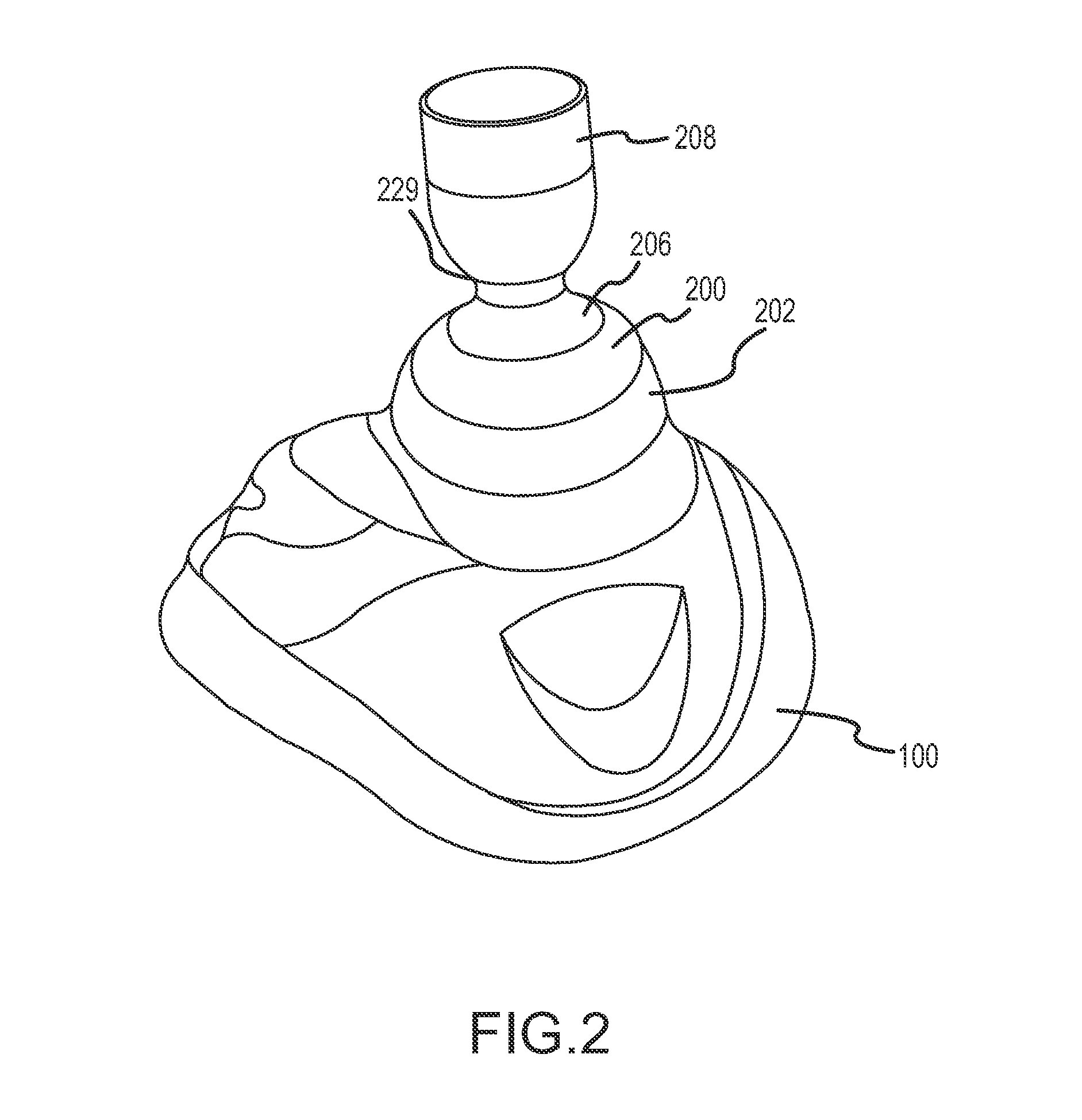 Vacuum and positive pressure ventilation systems and methods for intrathoracic pressure regulation