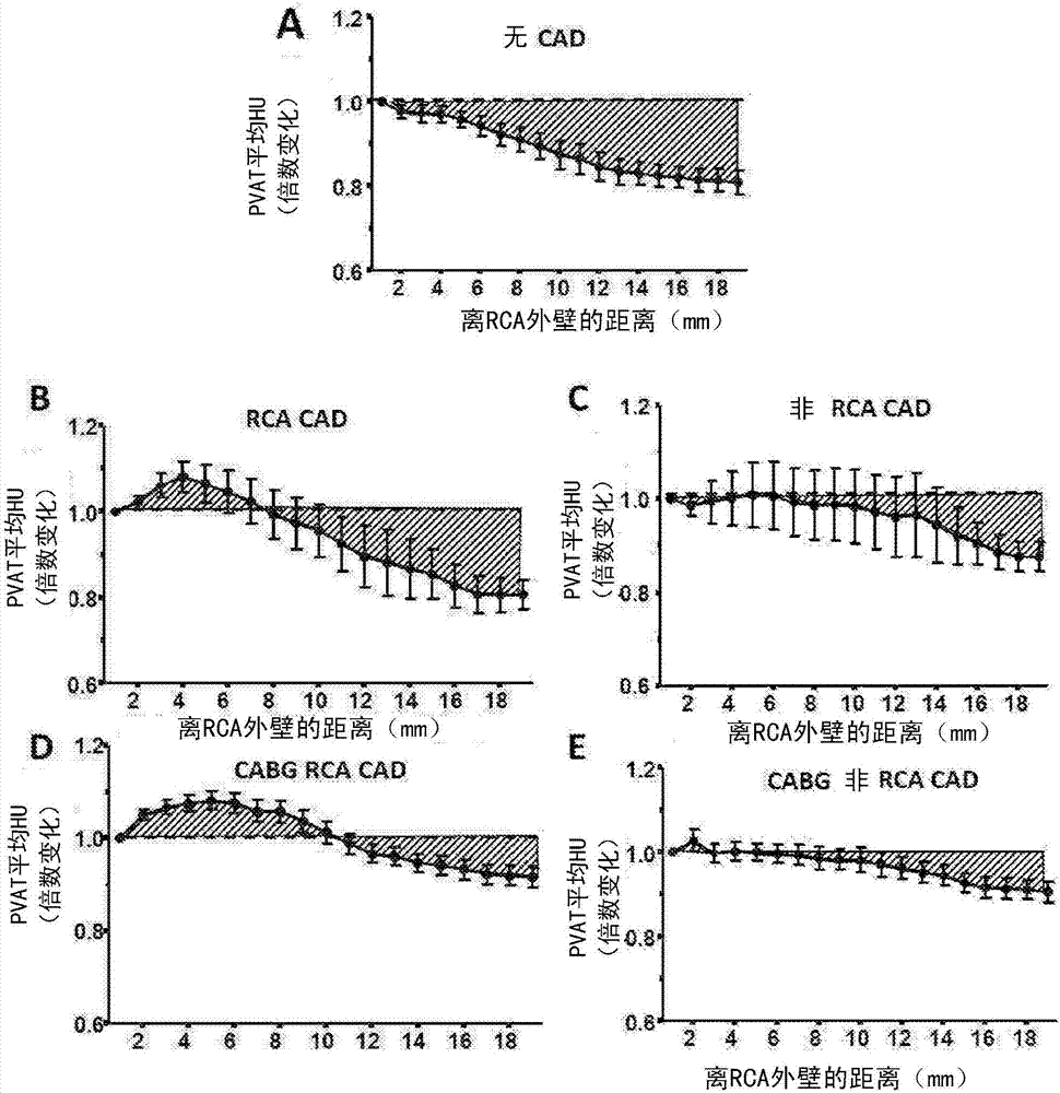 Method for characterisation of perivascular tissue