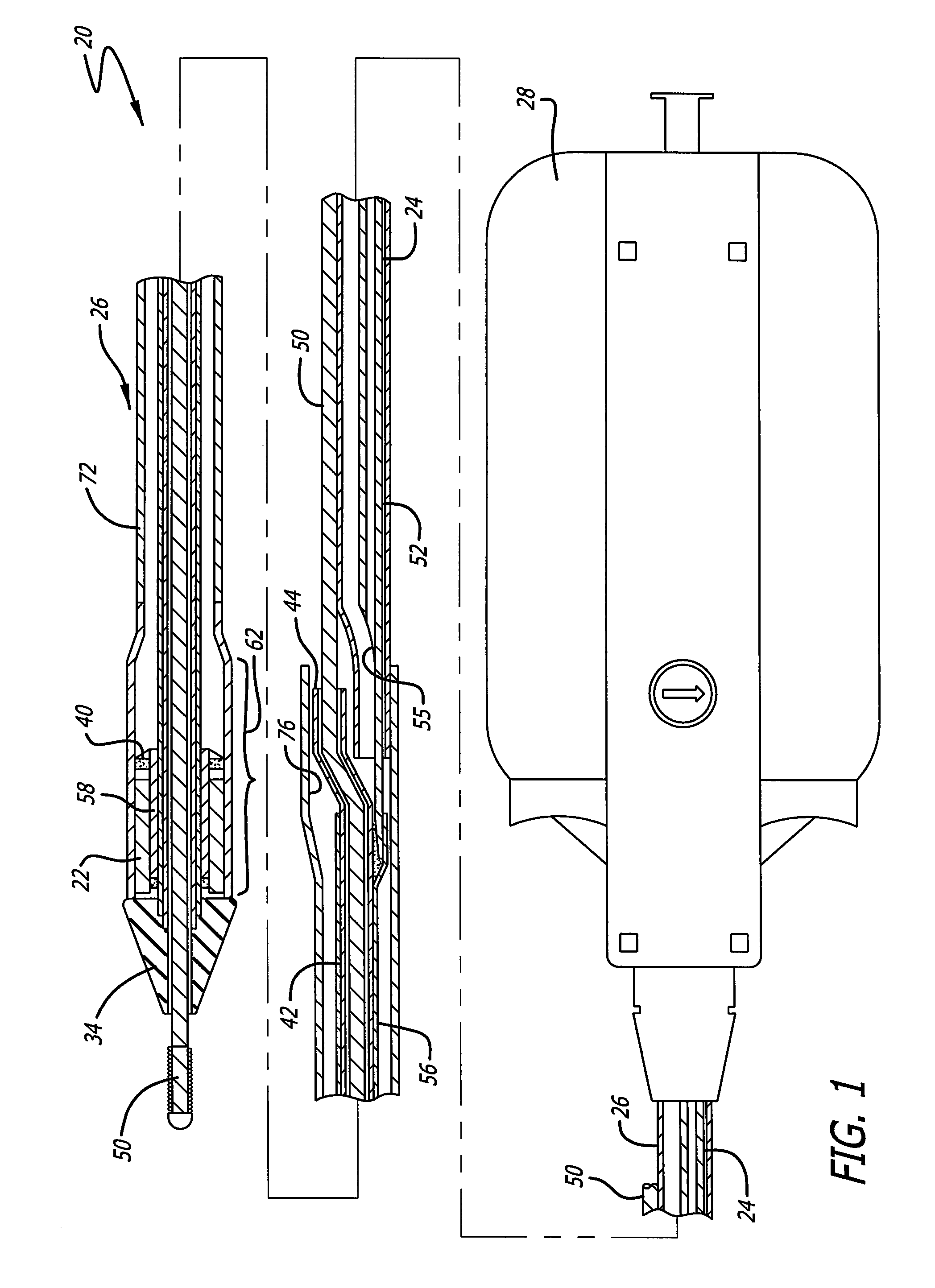 Rapid-exchange delivery systems for self-expanding stents