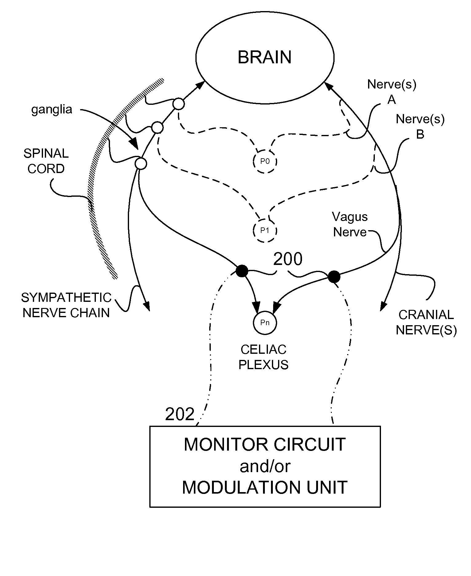 Methods And Apparatus For Treating Disorders Through Neurological And/Or Muscular Intervention