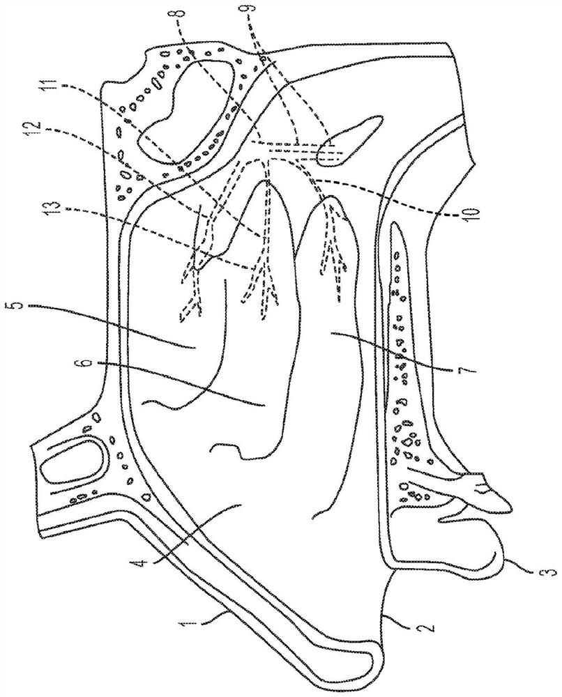 Devices and methods for treating ear, nose, and throat afflictions