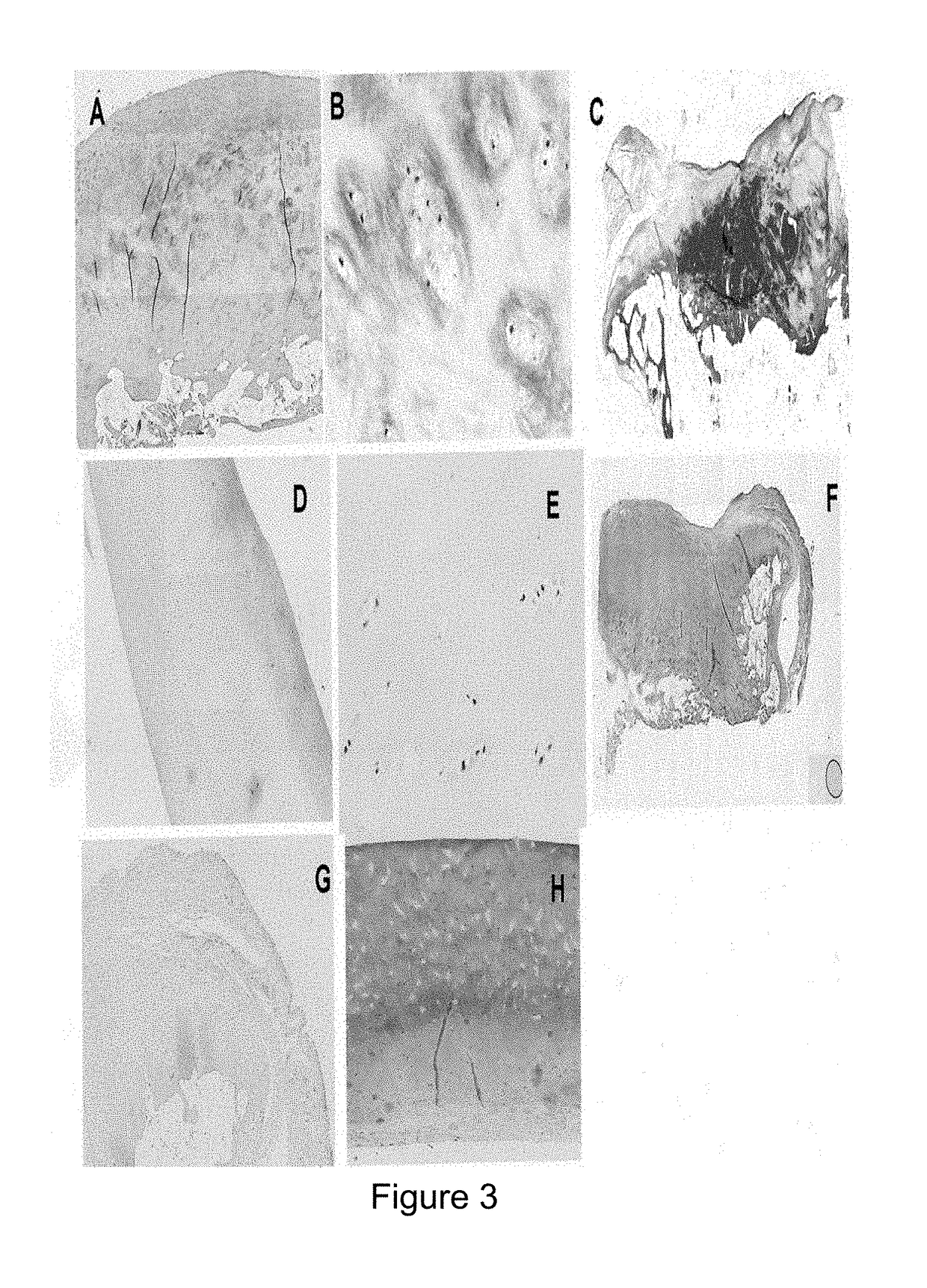 Antibody and use in diagnosis and therapy of arthropathies