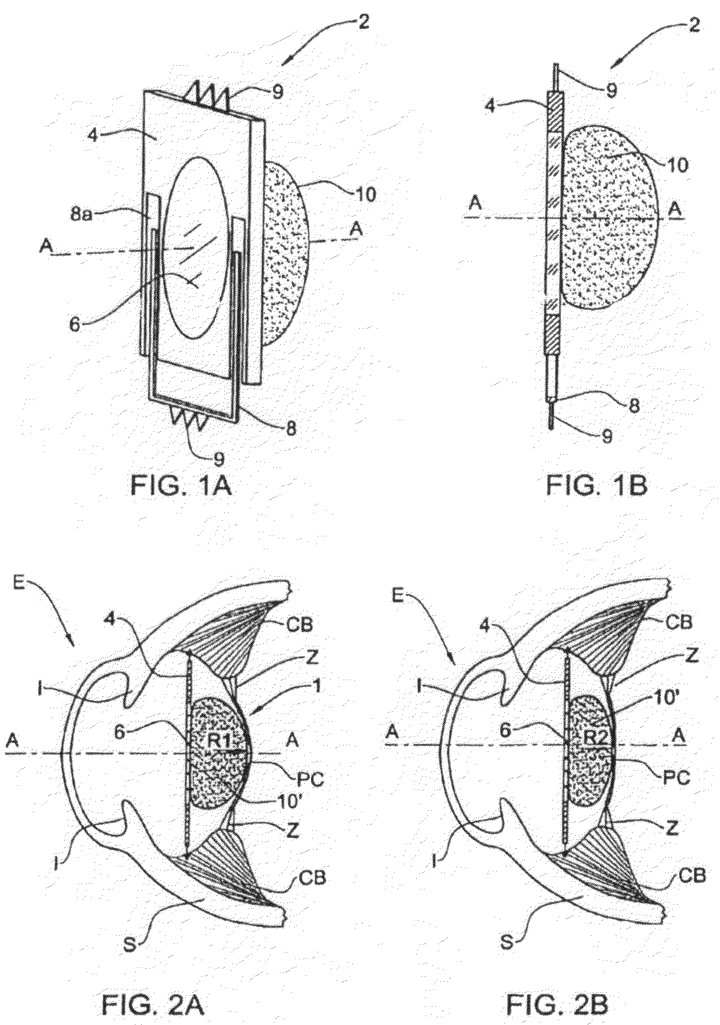 Accommodating lens assembly