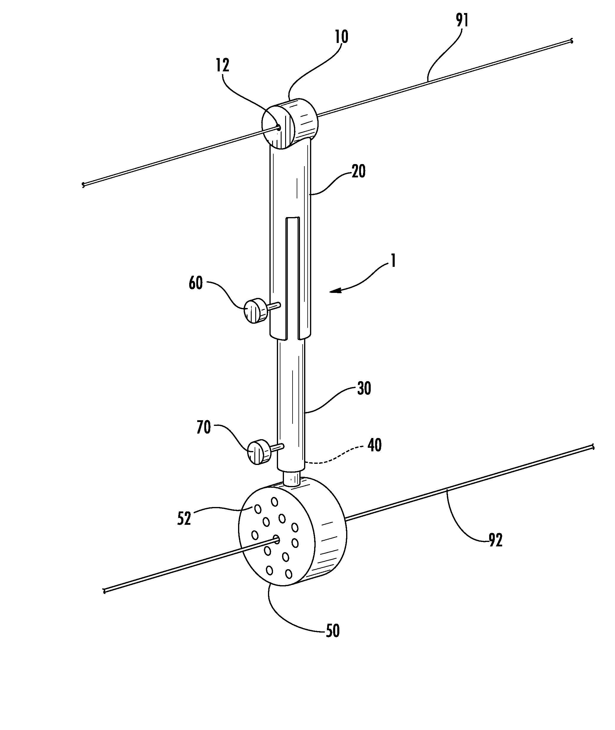 Guide Pin Placement for Hip Resurfacing