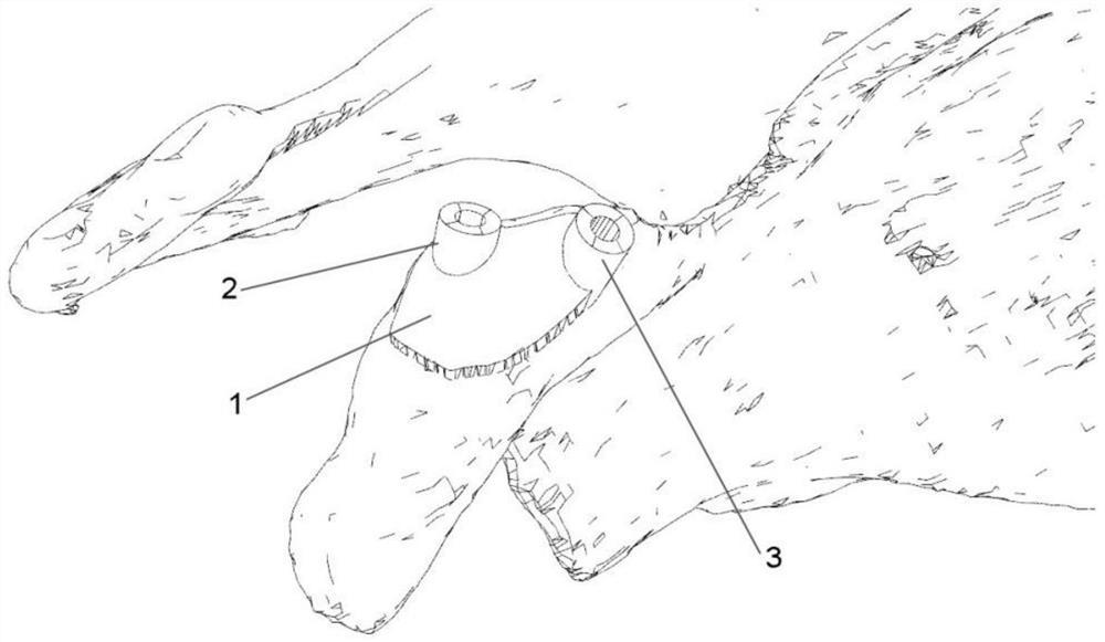 Navigation plate for individually assisting complete anatomical reconstruction of coracoclavicular ligament and manufacturing method thereof