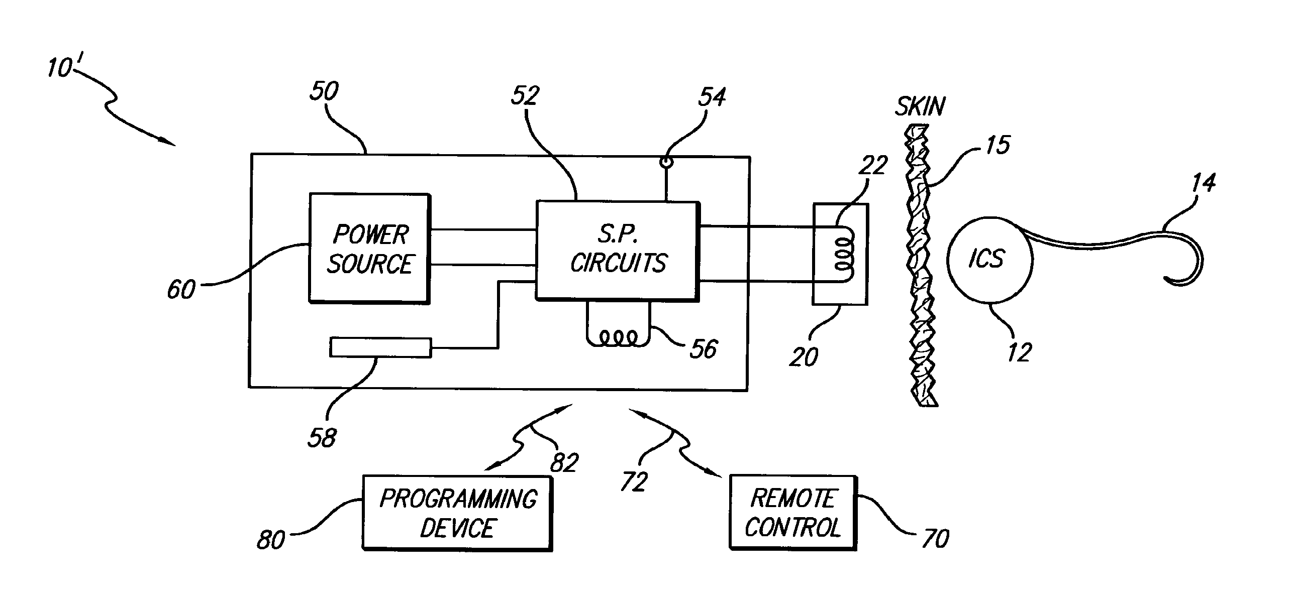 Cochlear Implant Sound Processor With Permanently Integrated Replenishable Power Source