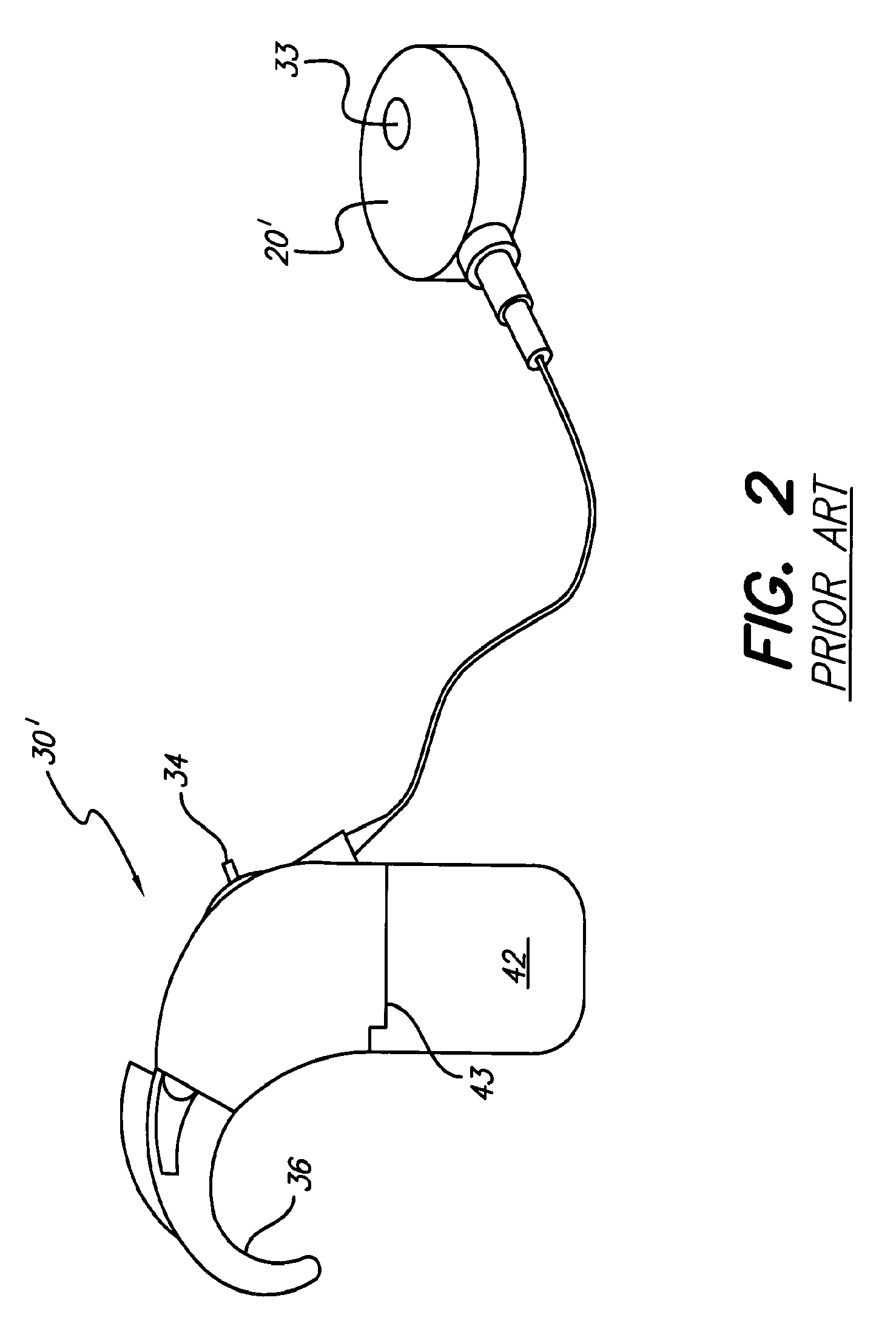 Cochlear Implant Sound Processor With Permanently Integrated Replenishable Power Source