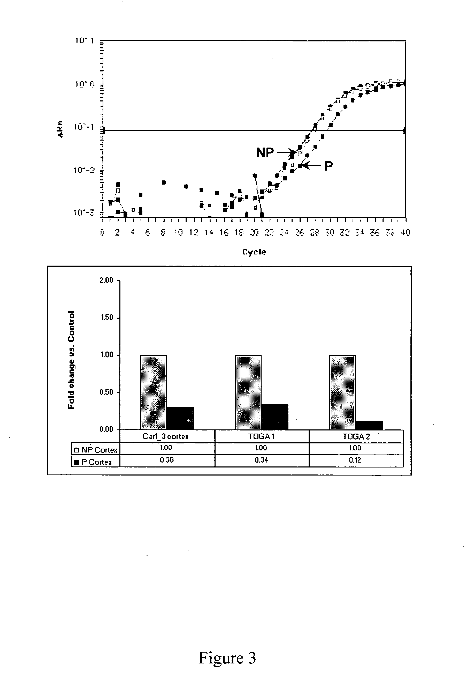 Gene expression and genetic changes implicated in alcoholism