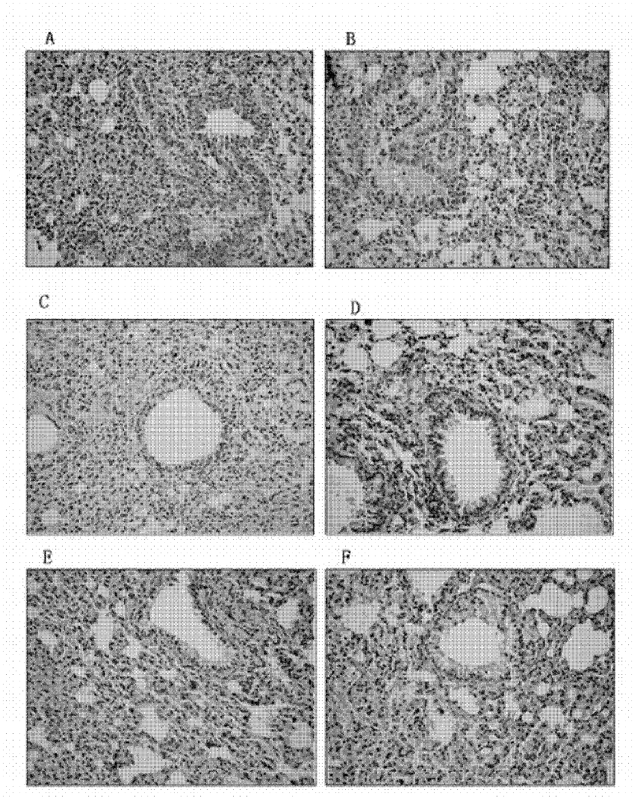 Application of icariin to preparation of medicament for treating bronchial asthma