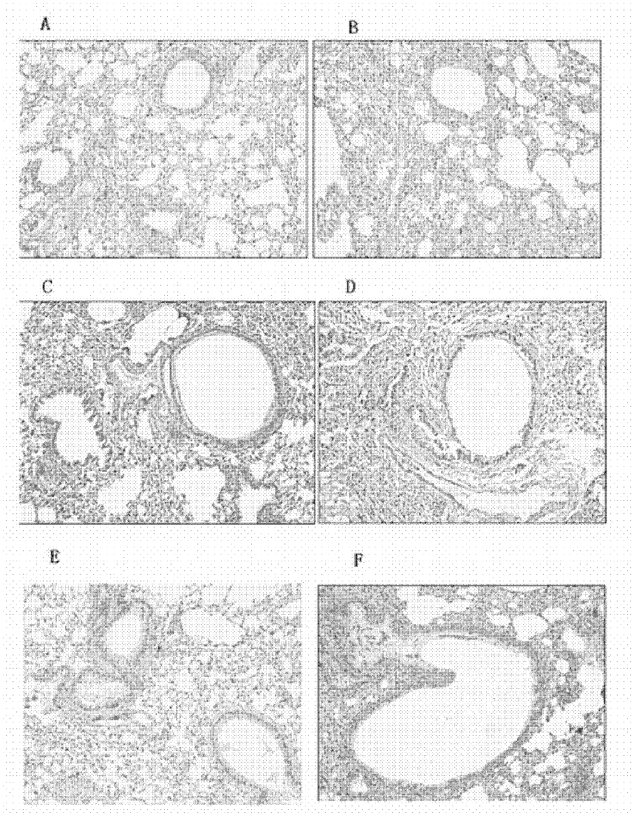 Application of icariin to preparation of medicament for treating bronchial asthma