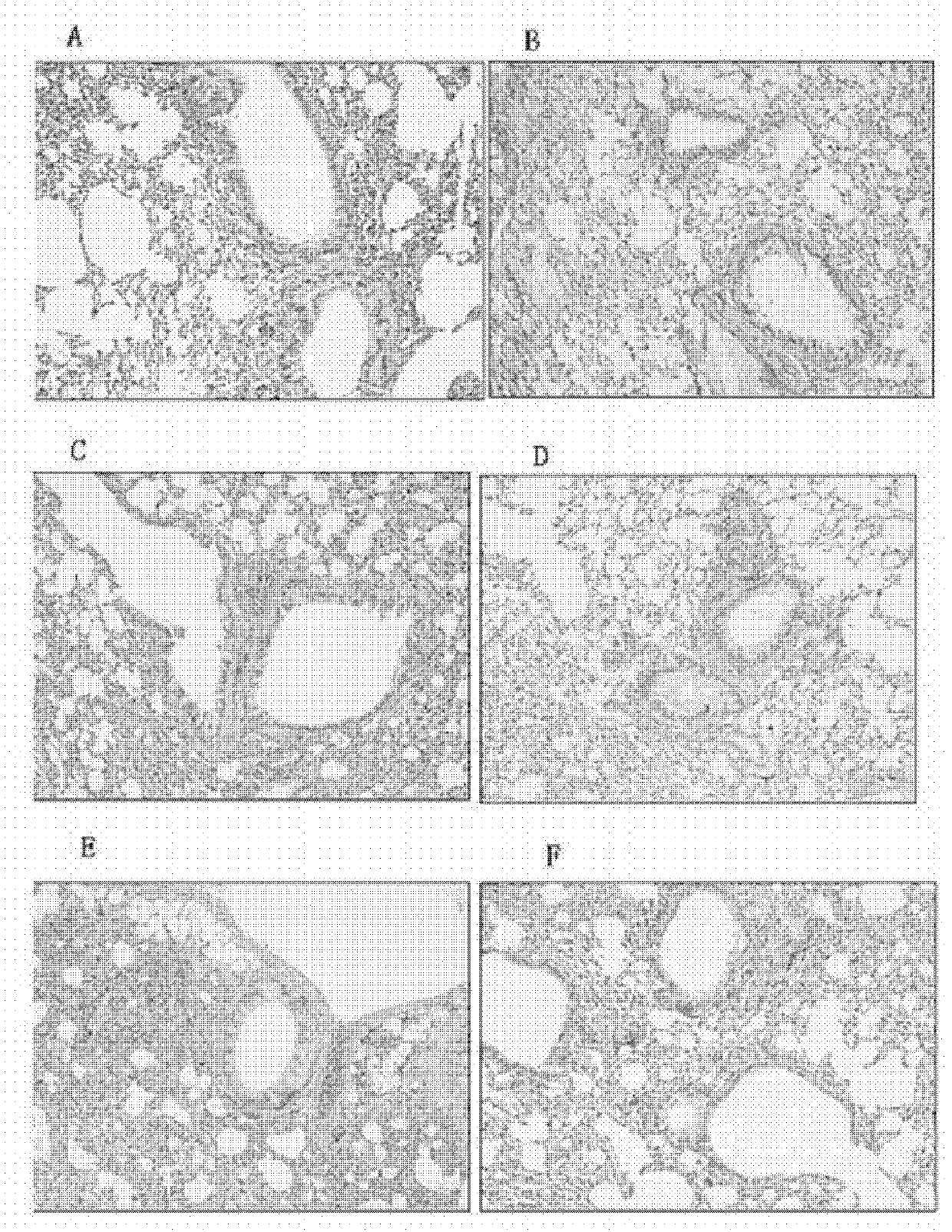 Application of icariin to preparation of medicament for treating bronchial asthma