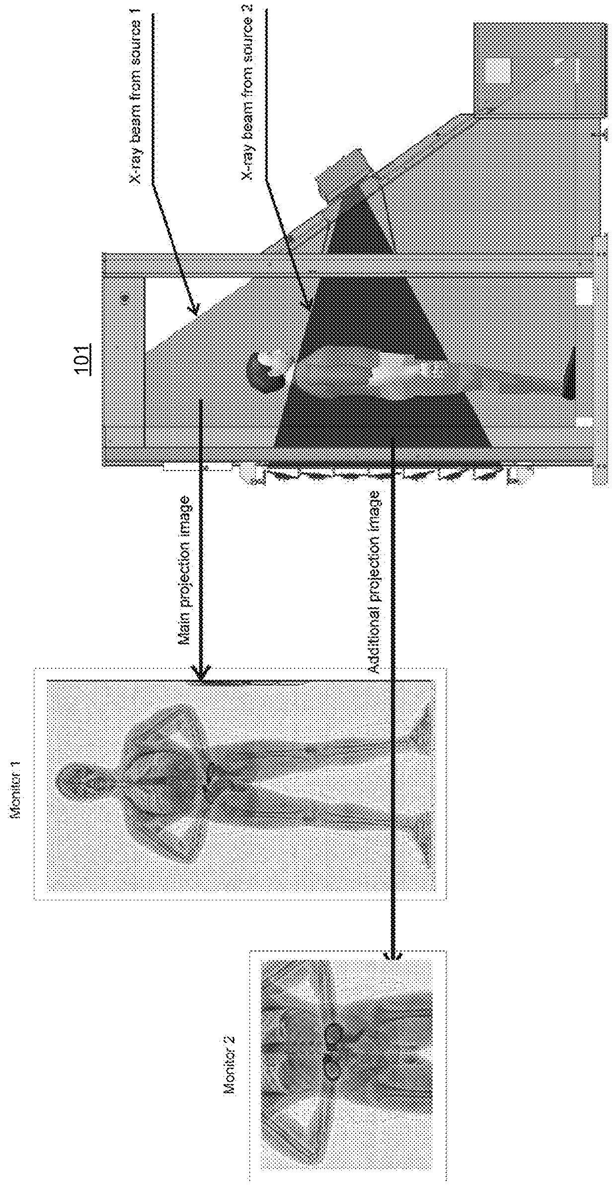 Multi-beam stereoscopic x-ray body scanner