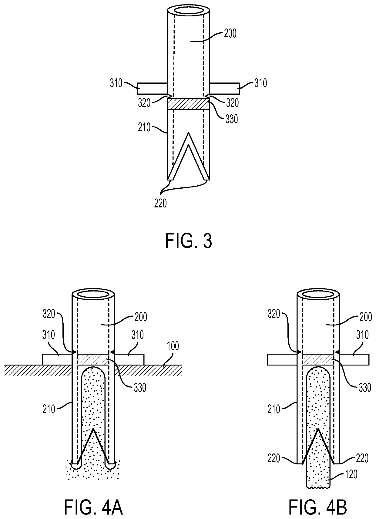 Method and apparatus for tissue copying and grafting