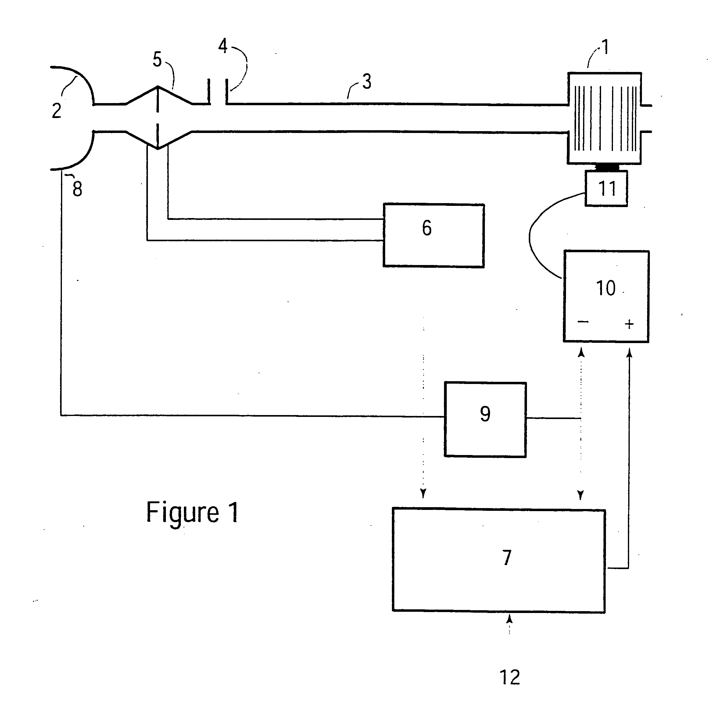 Method and apparatus to counterbalance intrinsic positive end expiratory pressure