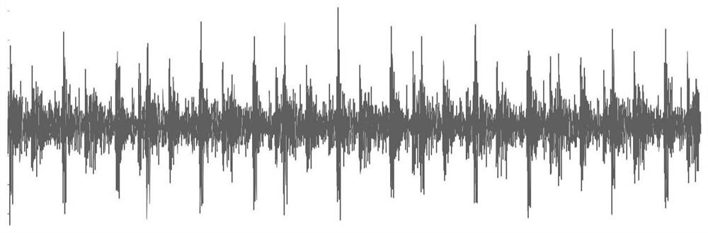 A Bearing Fault Classification Method Based on Neural Network Attention Mechanism