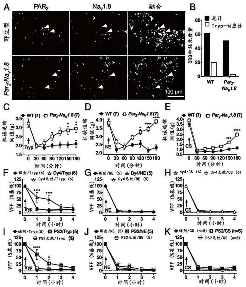 Inhibitors of protease activated receptor-2