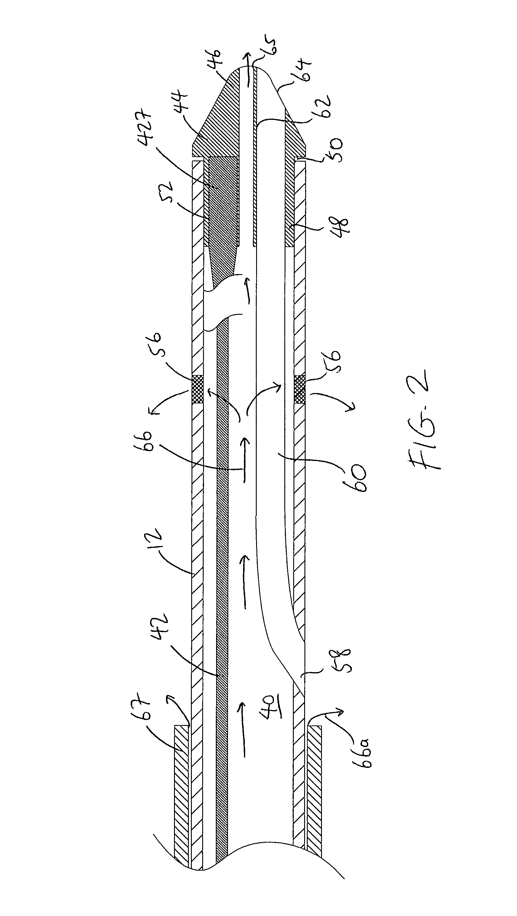 Therapeutic ultrasound system