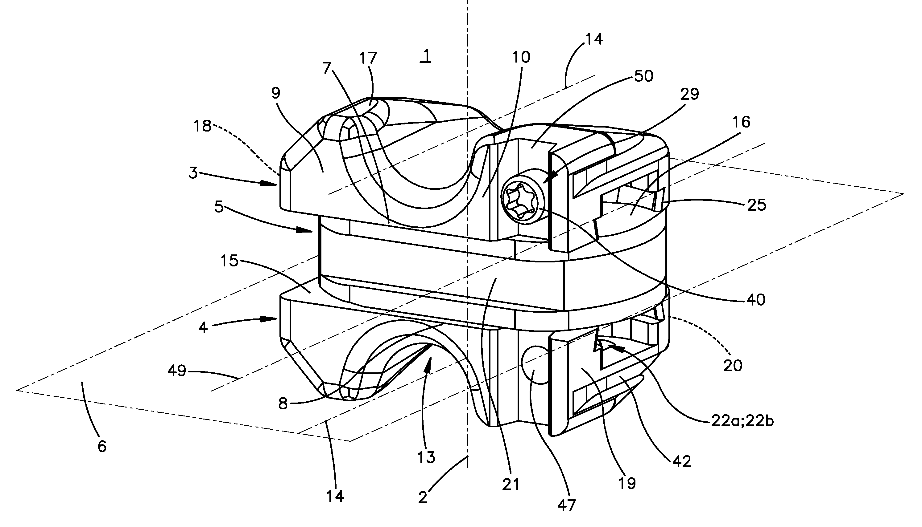 Intervertebral implant