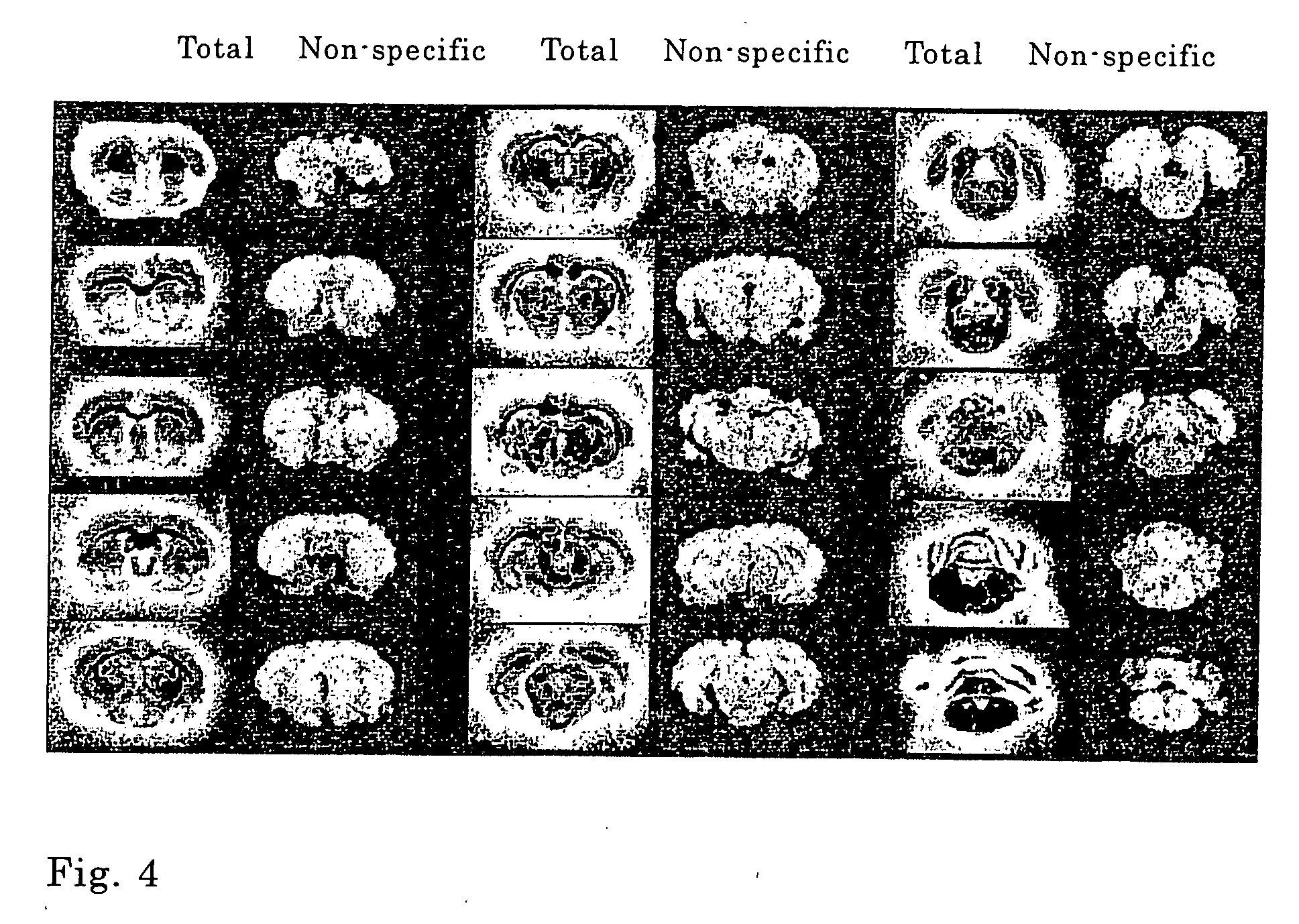 Radiolabeled 3-[3- (Benzoyl-Amido) Benzyloxy] Aspartic Acid Derivative and Method of Producing the Same