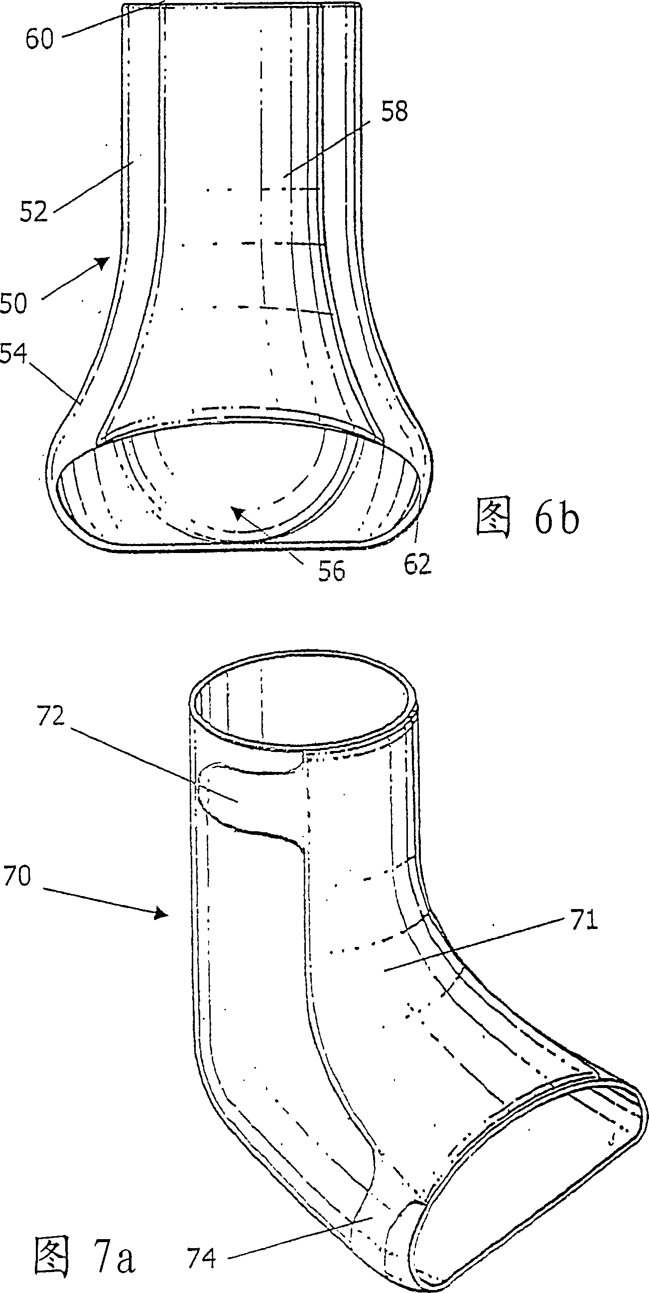 Ankle-foot orthosis