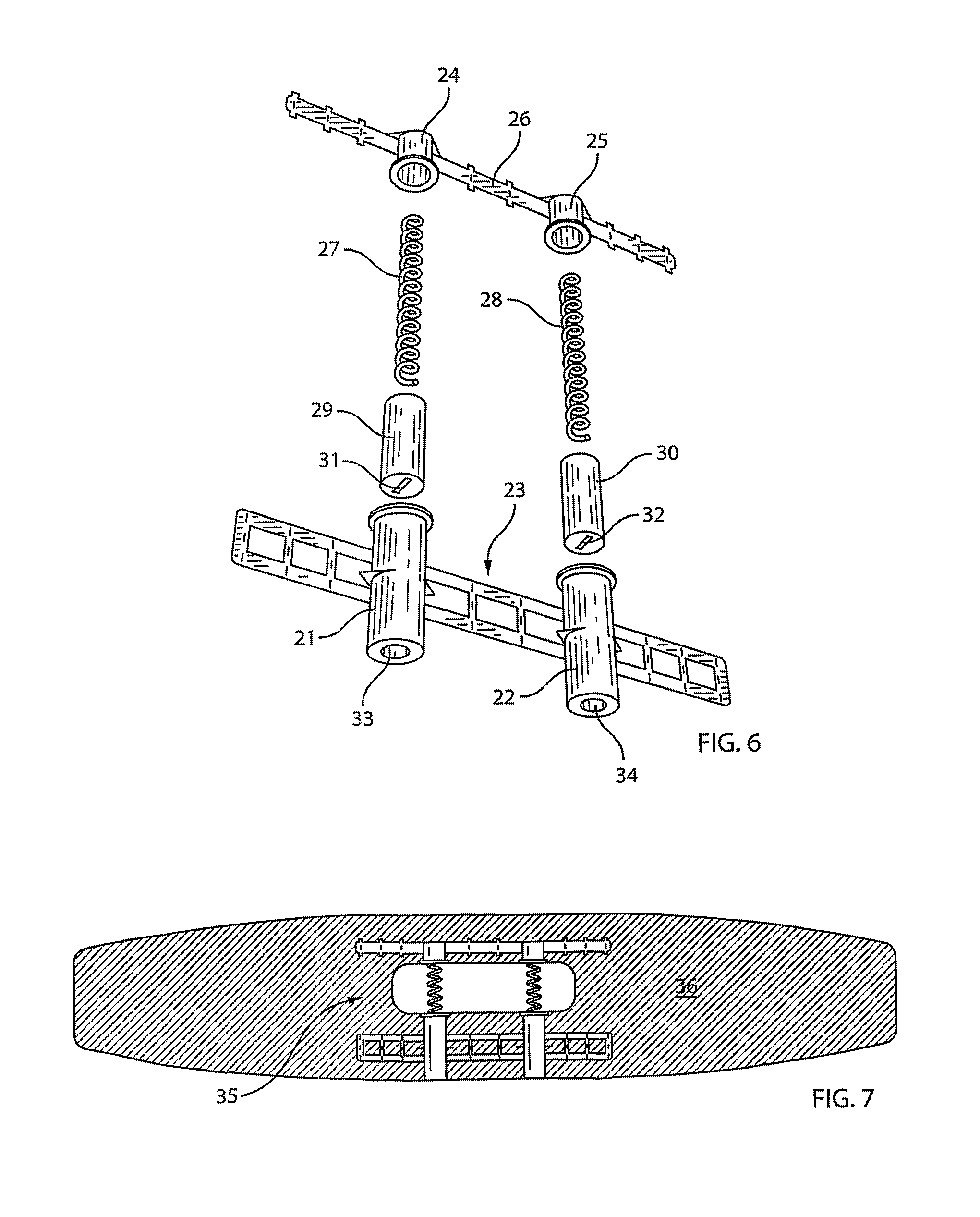 Anti-snore device